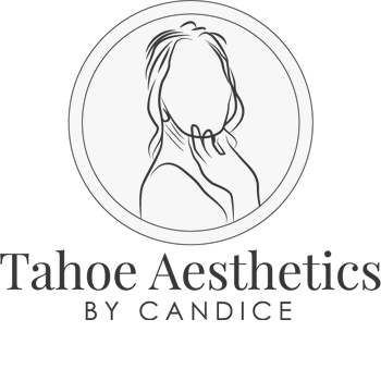 Tahoe Aesthetics by Candice